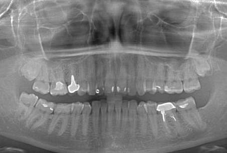Ортопантомограмма